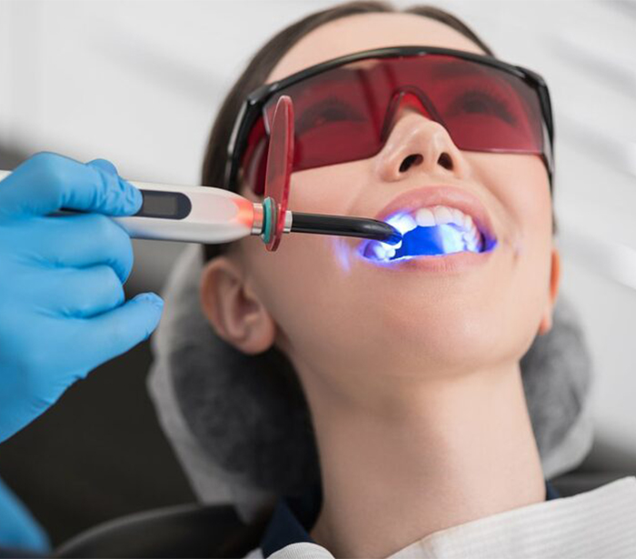 Отбеливание зубов - доступная цена стоматология в Краснодаре безболезненный вид процедуры | Doctor Lav