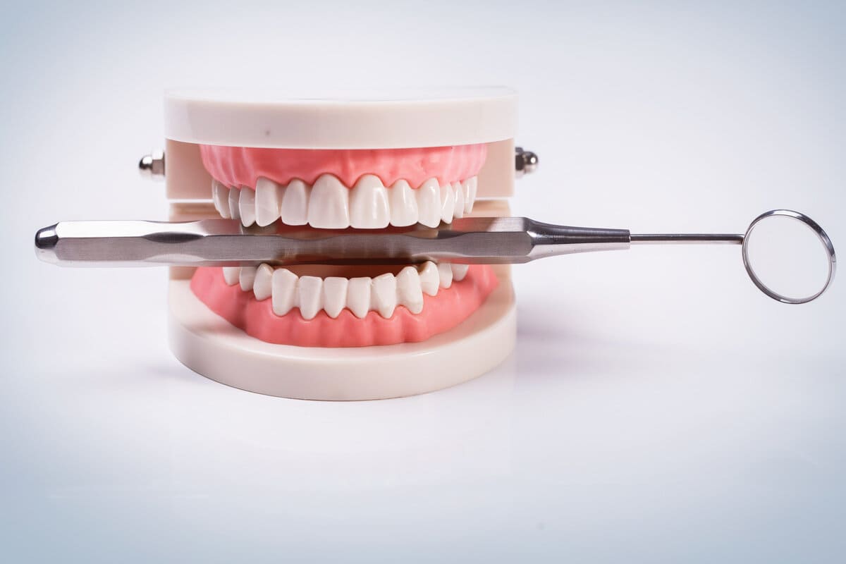 Этапы Протезирования передних зубов