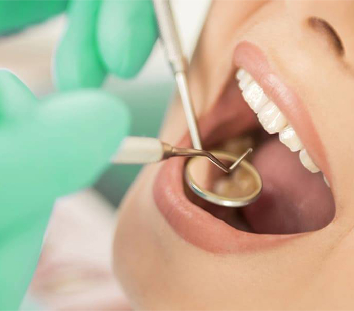 Лечение кариеса в стоматологии в Краснодаре
